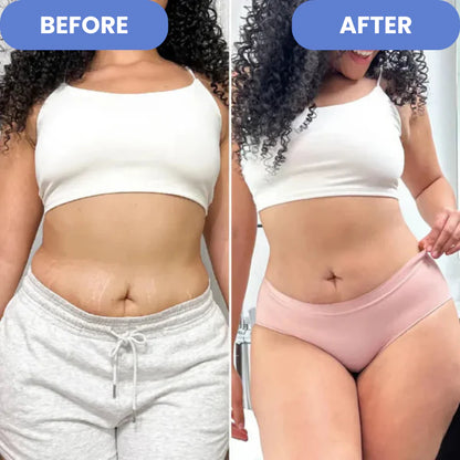 SculptEase - Traitement anti-cellulite 4 en 1